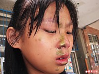 PILOT油漆筆爆裂傷女生